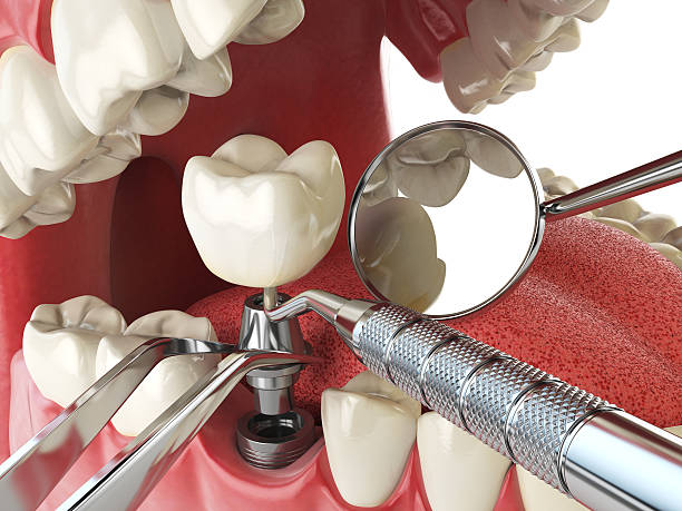  Union Mill, VA Emergency Dentist Pros